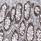 Immunohistochemical staining of human rectum shows strong cytoplasmic granular positivity in glandular cells.
