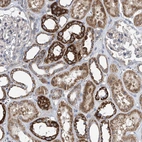 Immunohistochemical staining of human kidney shows strong cytoplasmic granular positivity in cells in tubules.