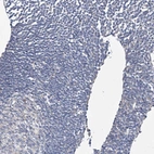 Immunohistochemical staining of human lymph node shows no positivity in non-germinal center cells as expected.