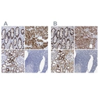 Anti-COQ3 Antibody