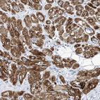 Immunohistochemical staining of human heart muscle shows strong cytoplasmic granular positivity in cardiomyocytes.
