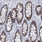 Immunohistochemical staining of human rectum shows strong cytoplasmic granular positivity in glandular cells.