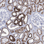 Immunohistochemical staining of human kidney shows strong cytoplasmic granular positivity in cells in tubules.