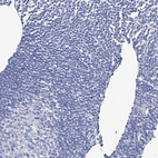 Immunohistochemical staining of human lymph node shows no positivity in non-germinal center cells as expected.