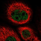 Immunofluorescent staining of human cell line A-431 shows localization to nucleoplasm.