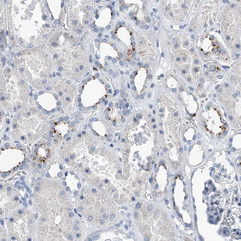 Anti-ZNF772 Antibody