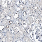 Anti-ZNF772 Antibody