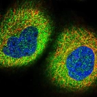 Immunofluorescent staining of human cell line A-431 shows positivity in cytoplasm.