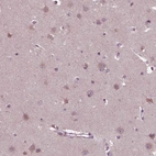 Immunohistochemical staining of human cerebral cortex shows high expression.