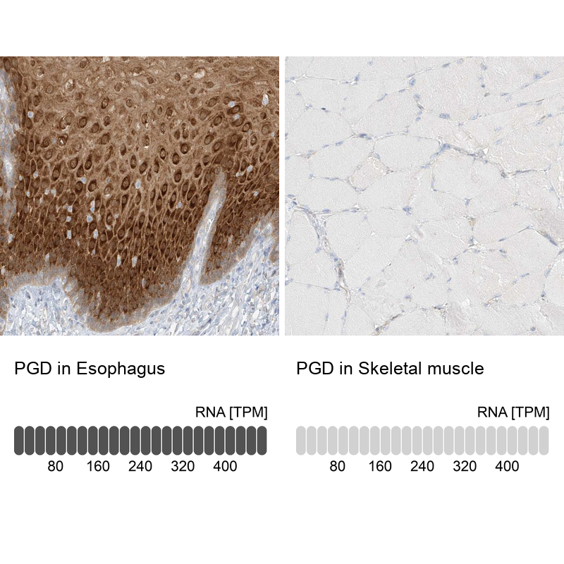Anti-PGD Antibody