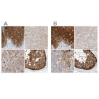 Immunohistochemical staining of human esophagus, liver, lymph node and testis using Anti-PGD antibody HPA031314 (A) shows similar protein distribution across tissues to independent antibody HPA031315 (B).