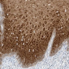 Immunohistochemical staining of human esophagus shows high expression.