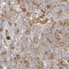 Immunohistochemical staining of human lymph node using Anti-PGD antibody HPA031314.