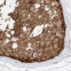 Immunohistochemical staining of human testis using Anti-PGD antibody HPA031314.
