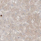Immunohistochemical staining of human liver using Anti-PGD antibody HPA031314.