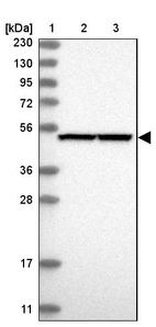 Lane 1: Marker [kDa] 230, 130, 95, 72, 56, 36, 28, 17, 11_br/_Lane 2: Human cell line RT-4_br/_Lane 3: Human cell line U-251MG sp