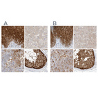 Immunohistochemical staining of human esophagus, liver, lymph node and testis using Anti-PGD antibody HPA031315 (A) shows similar protein distribution across tissues to independent antibody HPA031314 (B).