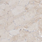 Immunohistochemical staining of human skeletal muscle shows low expression as expected.