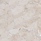 Immunohistochemical staining of human skeletal muscle shows low expression as expected.