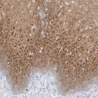 Immunohistochemical staining of human esophagus shows high expression.