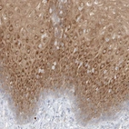Immunohistochemical staining of human esophagus shows high expression.