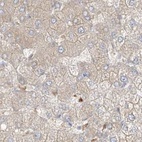 Immunohistochemical staining of human liver using Anti-PGD antibody HPA031315.