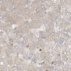 Immunohistochemical staining of human liver using Anti-PGD antibody HPA031315.