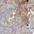 Immunohistochemical staining of human lymph node using Anti-PGD antibody HPA031315.