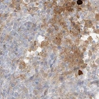 Immunohistochemical staining of human lymph node using Anti-PGD antibody HPA031315.