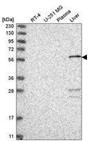 Western blot analysis in human cell line RT-4, human cell line U-251 MG, human plasma and human liver tissue.