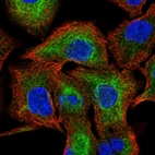 Immunofluorescent staining of human cell line A549 shows localization to cytosol & intermediate filaments.