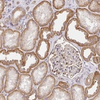 Immunohistochemical staining of human kidney shows strong cytoplasmic positivity in cells in tubules.