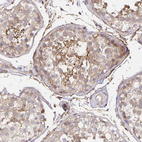 Immunohistochemical staining of human testis shows weak cytoplasmic positivity in cells in seminiferous ducts.