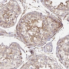 Immunohistochemical staining of human testis shows weak cytoplasmic positivity in cells in seminiferous ducts.