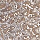 Anti-HHLA3 Antibody