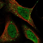 Immunofluorescent staining of human cell line U-2 OS shows localization to nucleoplasm & vesicles.