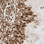 Immunohistochemical staining of human placenta shows strong cytoplasmic positivity in decidual cells.