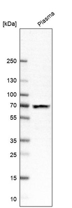 Western blot analysis in human plasma.