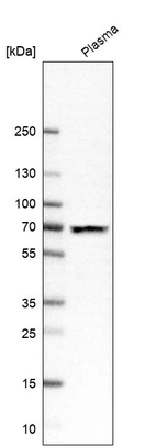 Western blot analysis in human plasma.