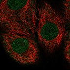 Immunofluorescent staining of human cell line MCF7 shows localization to nucleoplasm.