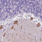 Anti-CLSTN2 Antibody