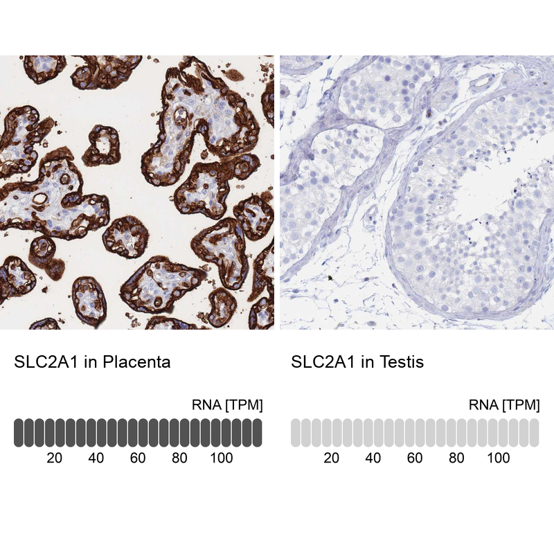 Anti-SLC2A1 Antibody