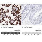 Anti-SLC2A1 Antibody