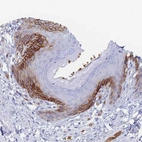 Immunohistochemical staining of human skin shows moderate membranous positivity in epidermal cells.