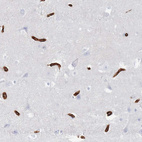 Immunohistochemical staining of human cerebral cortex shows strong membranous positivity in endothelial cells.