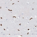 Immunohistochemical staining of human cerebral cortex shows strong membranous positivity in endothelial cells.