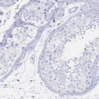 Immunohistochemical staining of human testis shows no membranous positivity in cells in seminiferous ducts as expected.