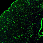 Anti-SLC2A1 Antibody