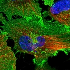Immunofluorescent staining of human cell line U-251 MG shows localization to plasma membrane.