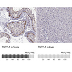 Anti-TSPYL5 Antibody